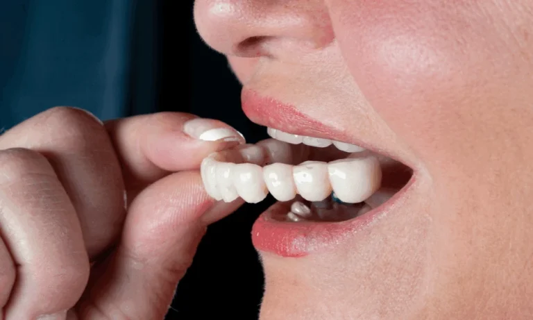 Same Day Temporary Teeth: What They Can And Can’t Do During Implant Healing
